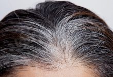 هل يمكن أن يعود الشعر الأبيض إلى لونه الأصلى | دراسة تكشف مفاجأة